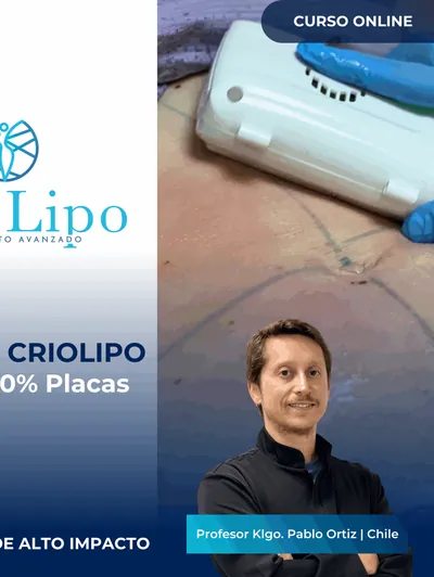 Método CrioLipo Placas